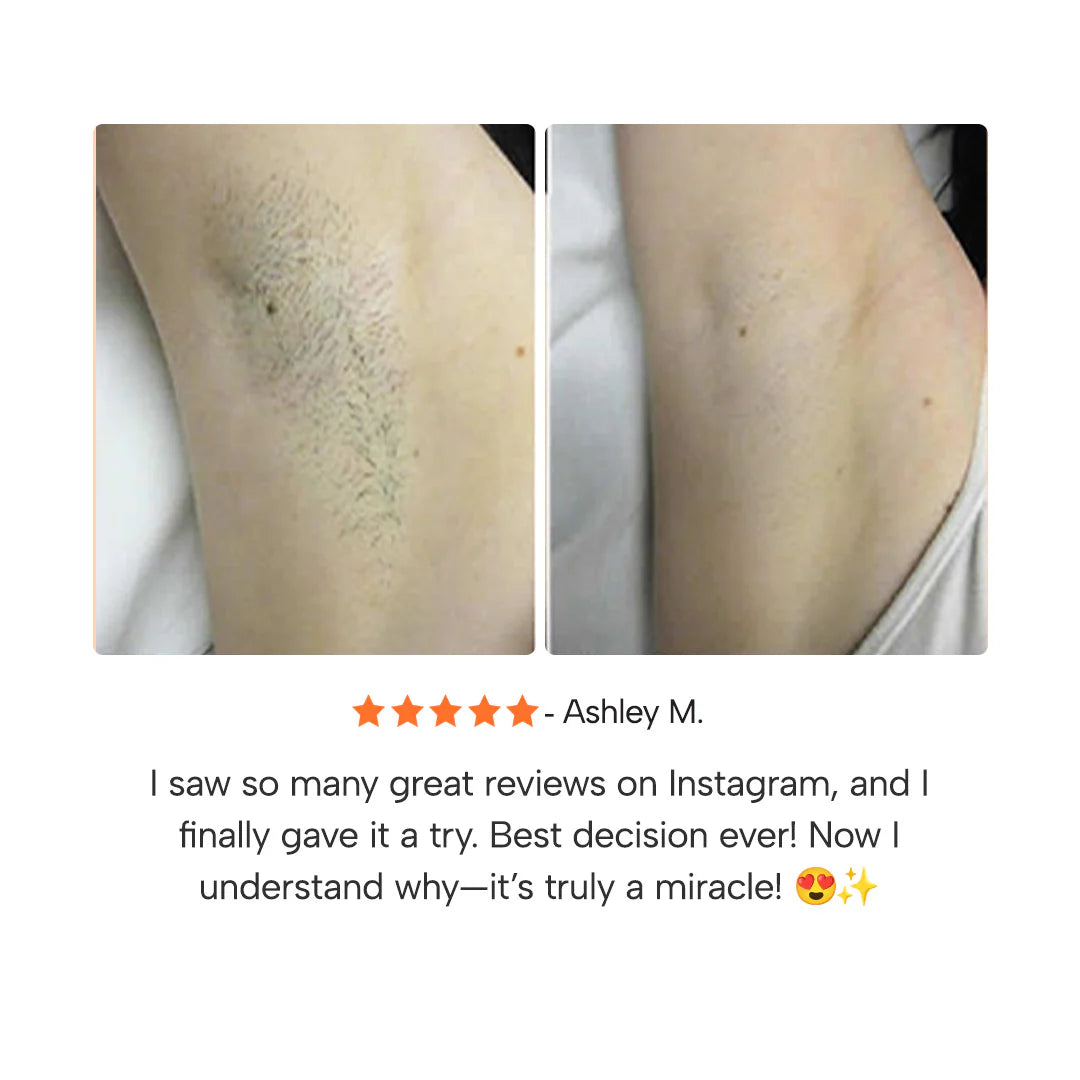 Hair Removal Gel Cream