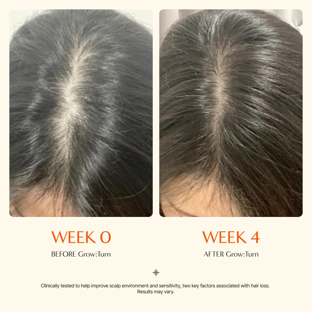 Growturn Hair Growth Serum™