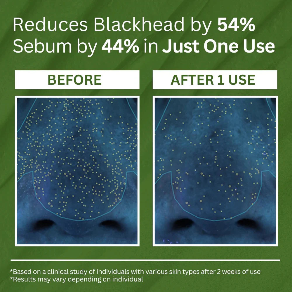 Holy Basil Bubble Deep Mask™