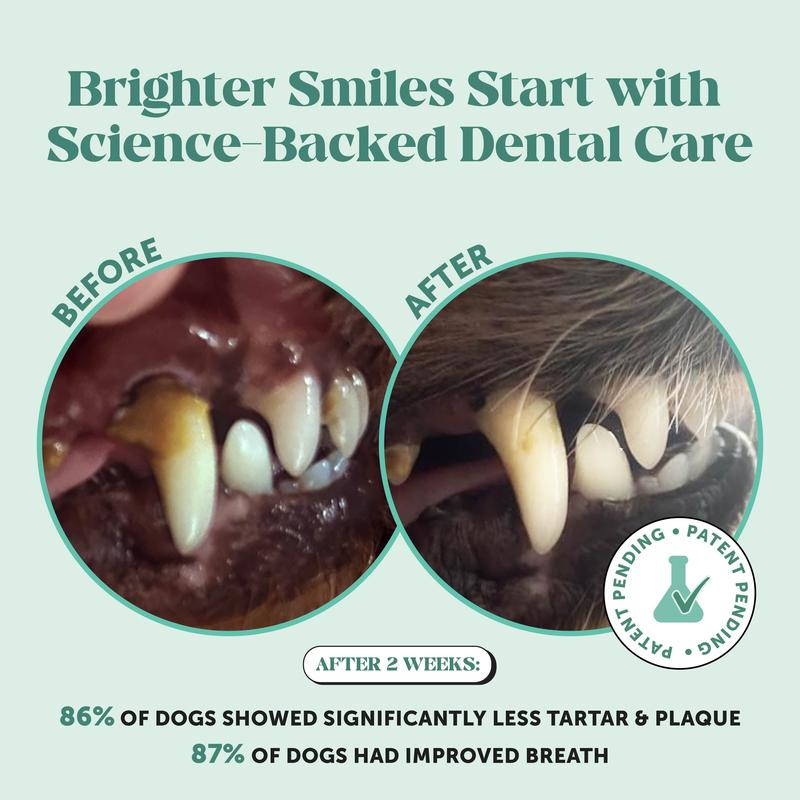 Dental Powder