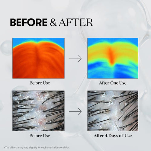 OSBY™ Reedle Boost Serum