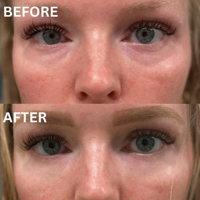 Osby EyeLift Patches™