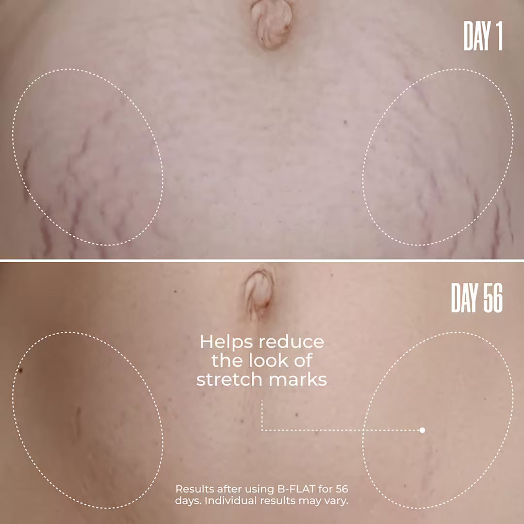 B-FLAT Firming Cream