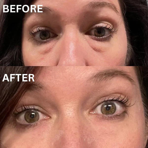 Osby EyeLift Patches™