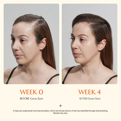 Growturn Hair Growth Serum™