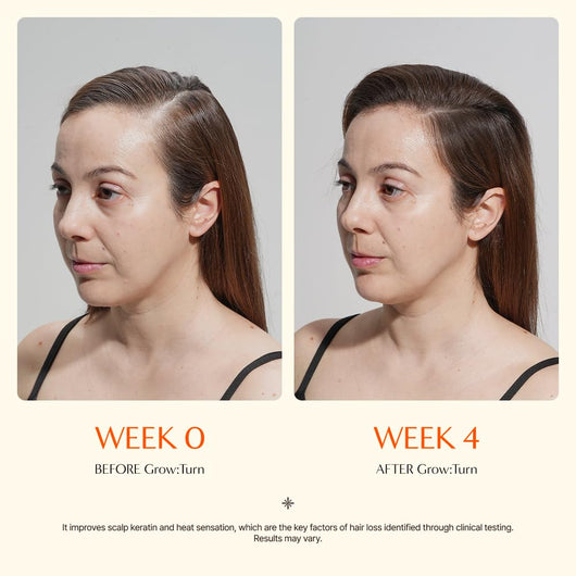 Growturn Hair Growth Serum™