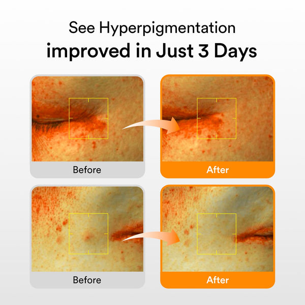 Advanced Dark Spot Corrector Serum™