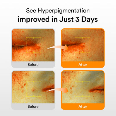 Advanced Dark Spot Corrector Serum™