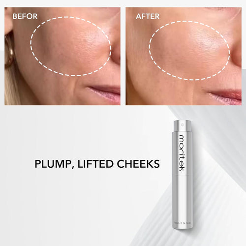 OSBY 30-Second Lift™