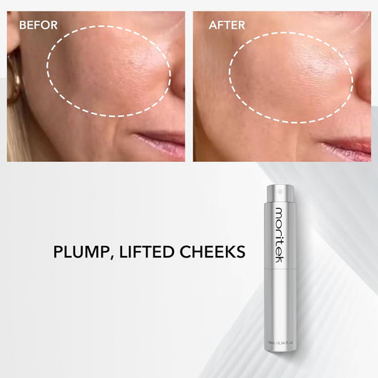 OSBY 30-Second Lift™