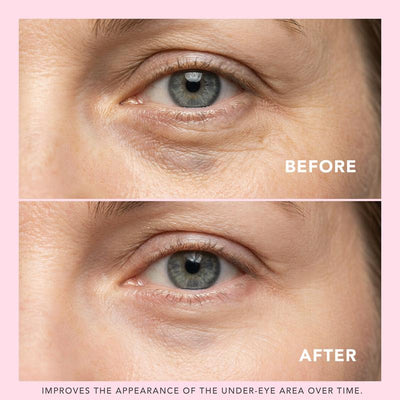 Correcting Eye Balm
