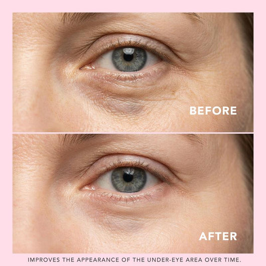 Correcting Eye Balm