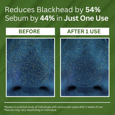 Holy Basil Bubble Deep Mask™