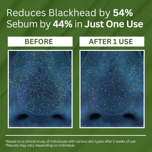 Holy Basil Bubble Deep Mask™