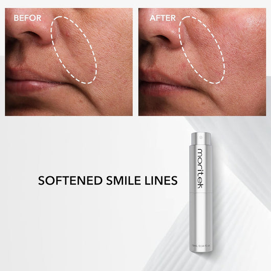 OSBY 30-Second Lift™