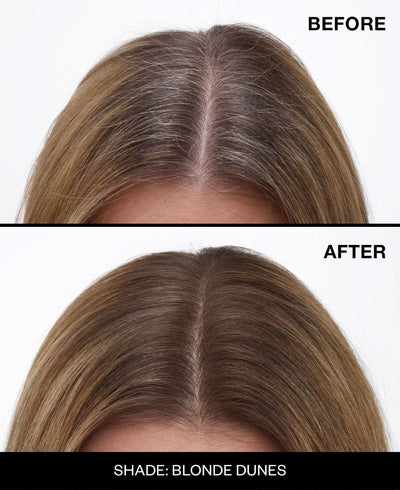 Never Miss™ Root Spray