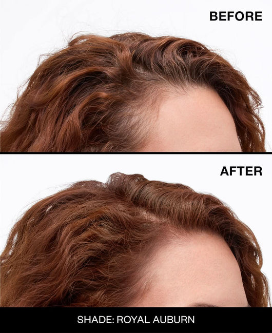 Never Miss™ Root Spray