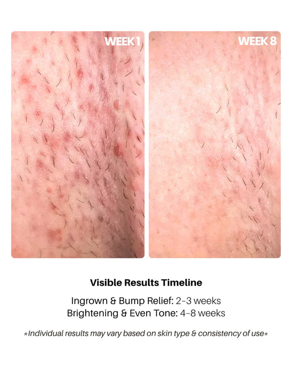 Bright Bikini Line Serum