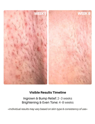 Bright Bikini Line Serum