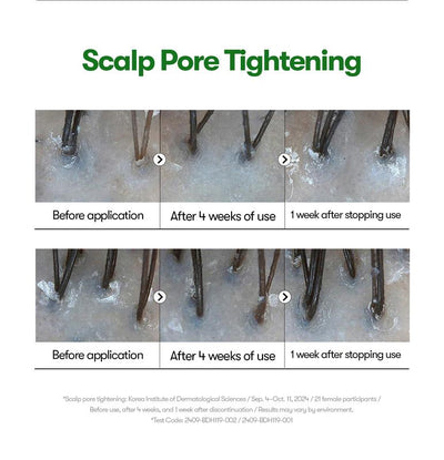 OSBY™ Reedle Boost Serum