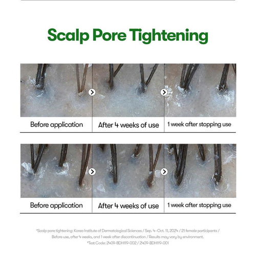 OSBY™ Reedle Boost Serum