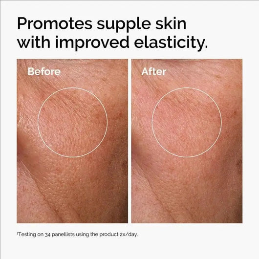 Crow's Feet & Eye Lift Serum