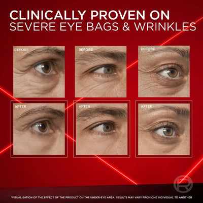 Revitalift™ Eye Bag Cream